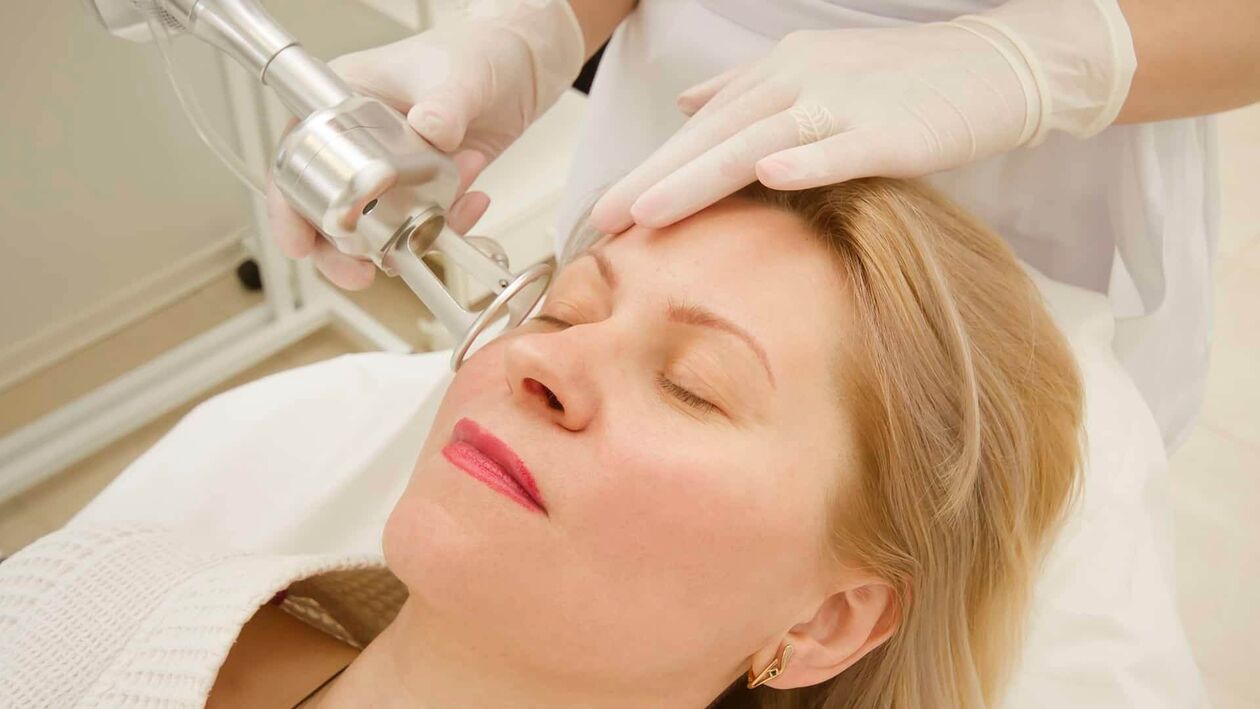 Laser treatment to rejuvenate facial skin